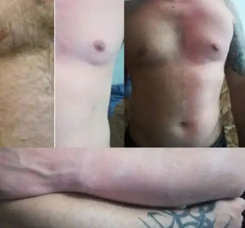 Шугаринг, фотография 1
