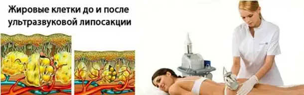косметология, фотография 2