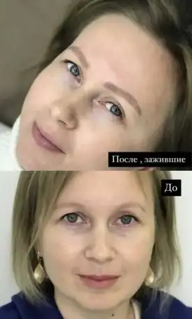 Перманент бровей волосками на год, фотография 1