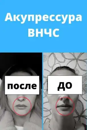 Акупрессура подзатылочных мышц, фотография 3