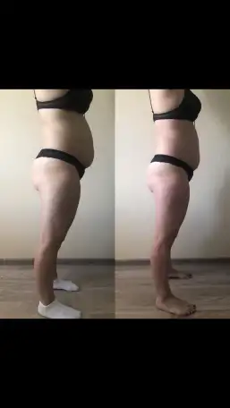 Аппаратный массаж и Эпиляция, фотография 1