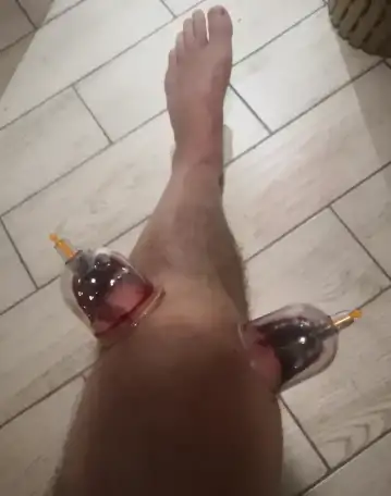 Пиявки, фотография 4