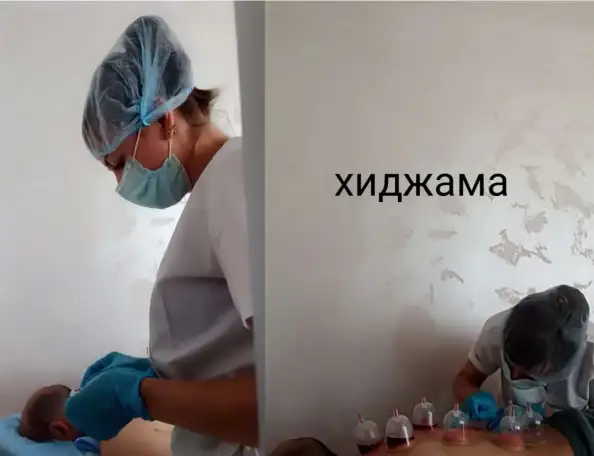 Медицинский массаж, Хиджама, фотография 2