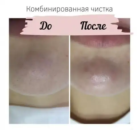 КОСМЕТОЛОГИЧЕСКИЕ УСЛУГИ, фотография 2