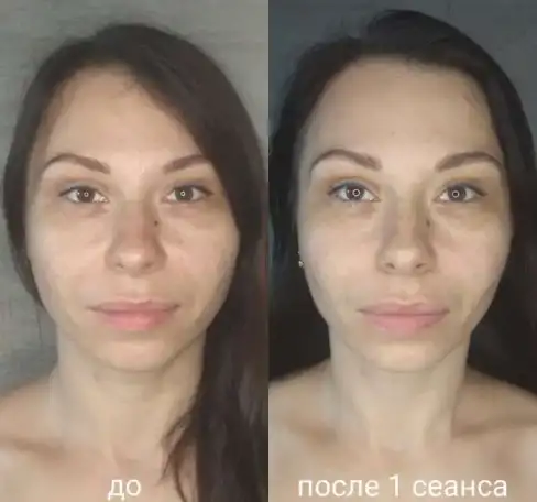 Массаж лица, фотография 5