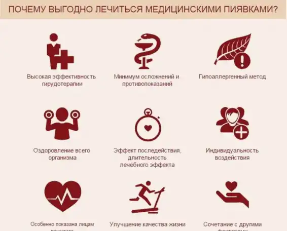 Пиявки на дому в Москве. Постановка медицинских пиявок на дому., фотография 7