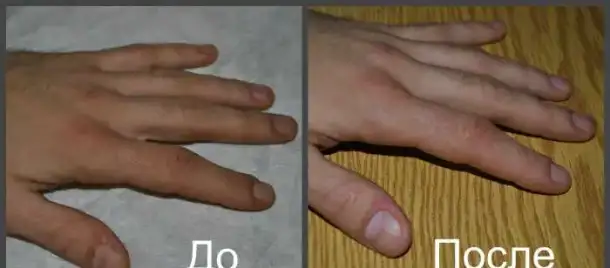 Маникюр, педикюр, гель-лак, фотография 4