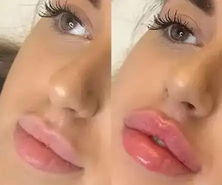 Услуги косметолога в п.Энем, фотография 1