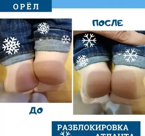 Акупрессура подзатылочных мышц, фотография 5