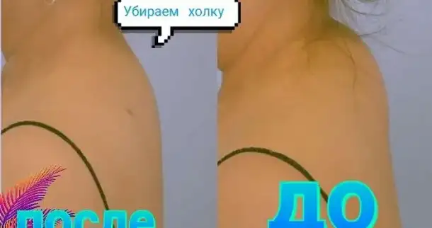 Услуги массажа, фотография 8
