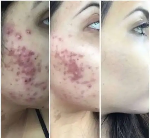 Сет Gemma, корейская косметика, Gemmove Queen, фотография 12