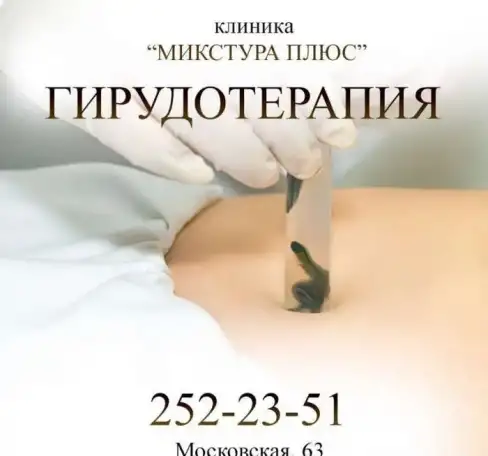 Лечение пиявками, фотография 1