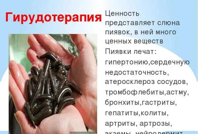 Пиявки на дому в Москве. Постановка медицинских пиявок на дому., фотография 1
