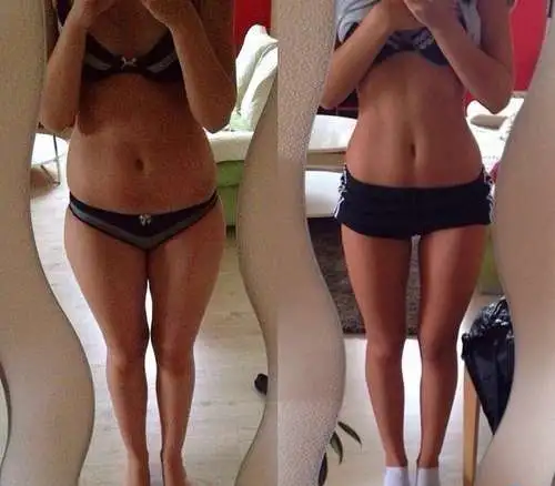 Медовый и антицеллюлитный массаж, фотография 2