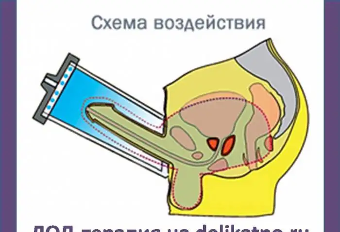 УЗИ, ЭКГ, ЛОД-терапия, анализы, капельницы, инъекции, консультации врачей в центре СПб, фотография 11