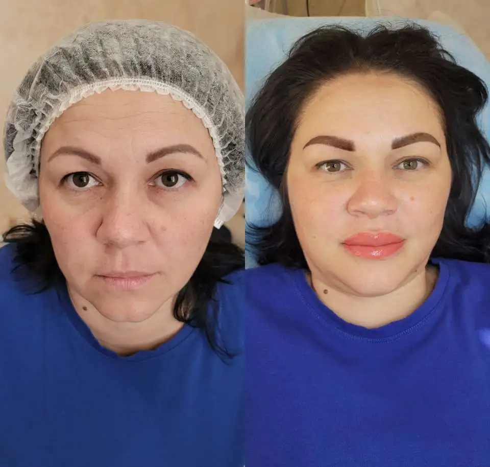 Косметолог с медицинским и, фотография 8