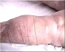 Массаж при остеохондрозе, гипертонической болезни, фотография 7