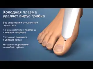 Холодная плазма, фотография 3