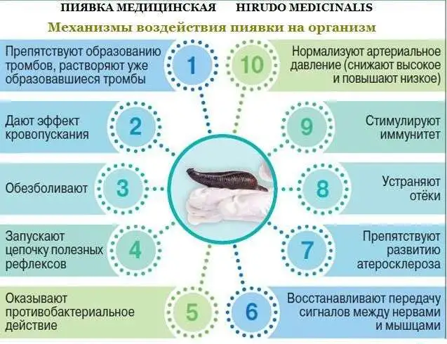 ГИРУДОТЕРАПИЯ НА ДОМУ, фотография 3