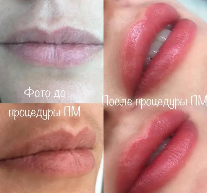Перманентный макияж, удаление, окрашивание, фотография 1
