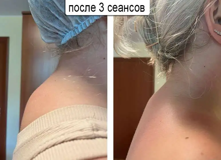 Массаж холки на шее, фотография 3