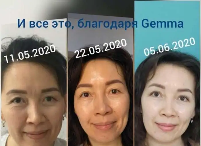 Сет Gemma, корейская косметика, Gemmove Queen, фотография 4
