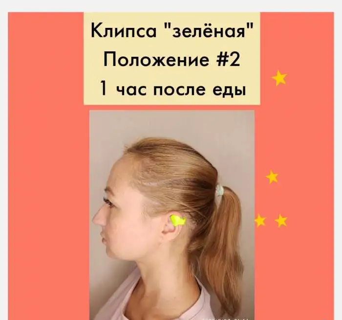 Магнитная клипса для похудения с нанопокрытием DN, фотография 6