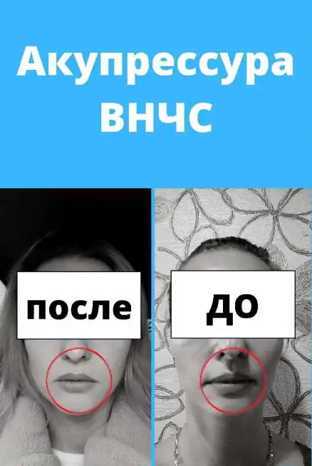 Акупрессура подзатылочных мышц, фотография 3