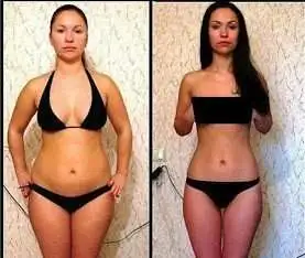 Антицеллюлитный массаж в Новой Адыгее, фотография 1