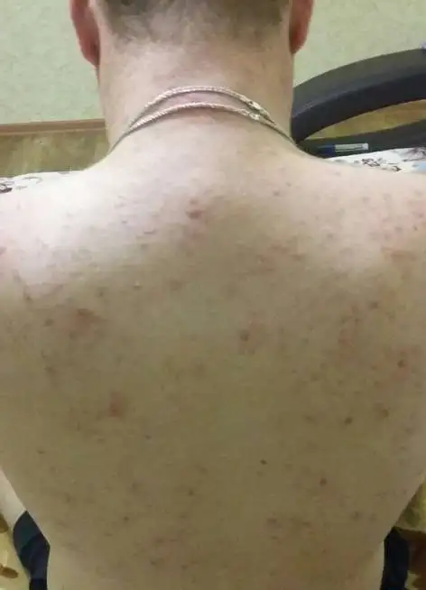 Требуются модели, фотография 4