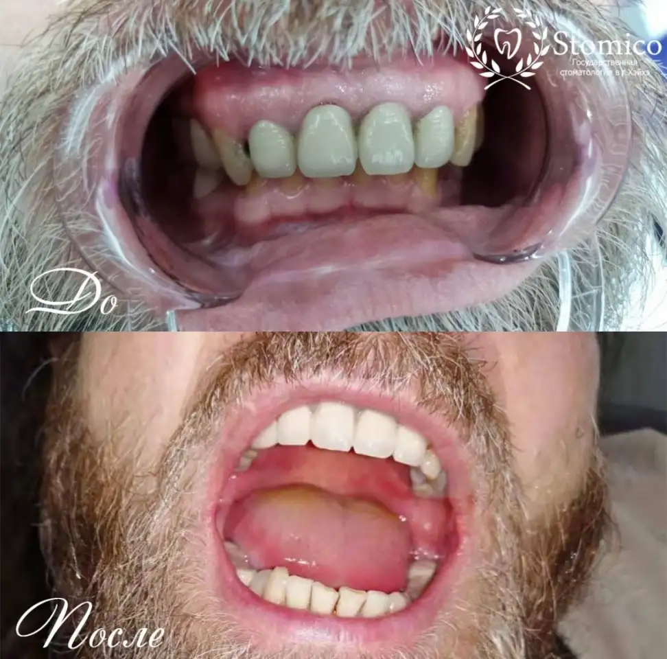 Лечение и протезирование зубов в Китае, фотография 2
