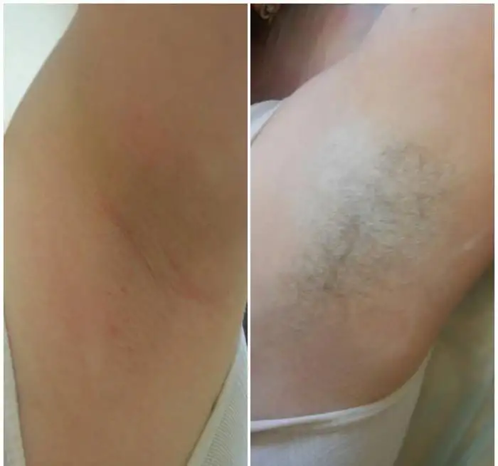 SPA-Шугаринг - сахарная депиляция в Сормово, фотография 1