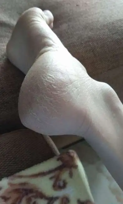 Педекюр пожилым людям, фотография 7