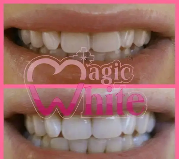 Студия отбеливания зубов MagicWhite, фотография 4