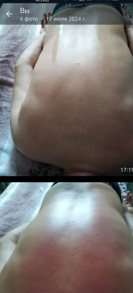Массаж, фотография 2
