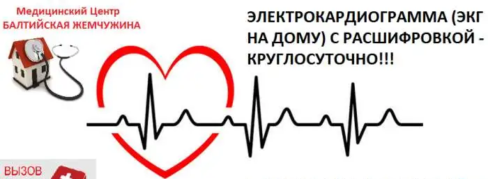 ЭКГ электрокардиография с расшифровкой, фотография 1