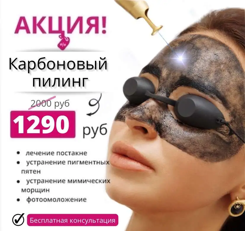 Карбоновый пилинг, фотография 2