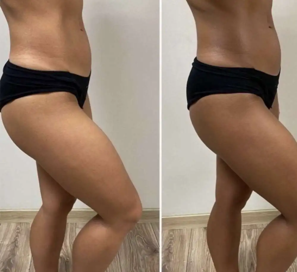 Моментальный загар, фотография 2