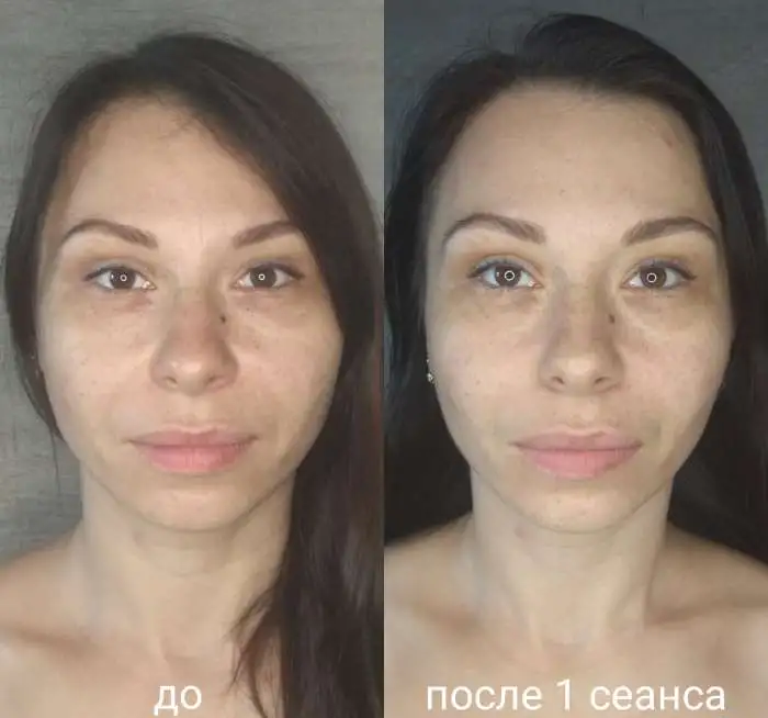 Массаж лица, фотография 5