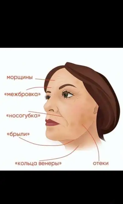 Скульптурный массаж лица. Результат после первого раза., фотография 2