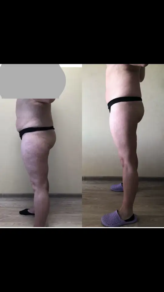 Аппаратный массаж и Эпиляция, фотография 2