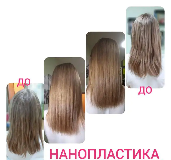 Ботокс, биопластика, нанопластика, кератин, фотография 7