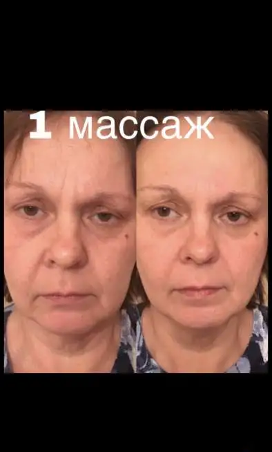 Массаж, различные техники, для детей и взрослых., фотография 6