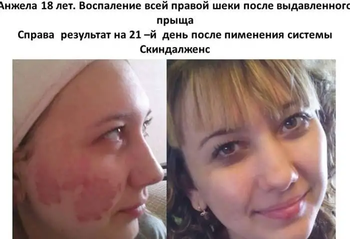 Продукция NHT Global в Красноярске и в Красноярском крае, фотография 6