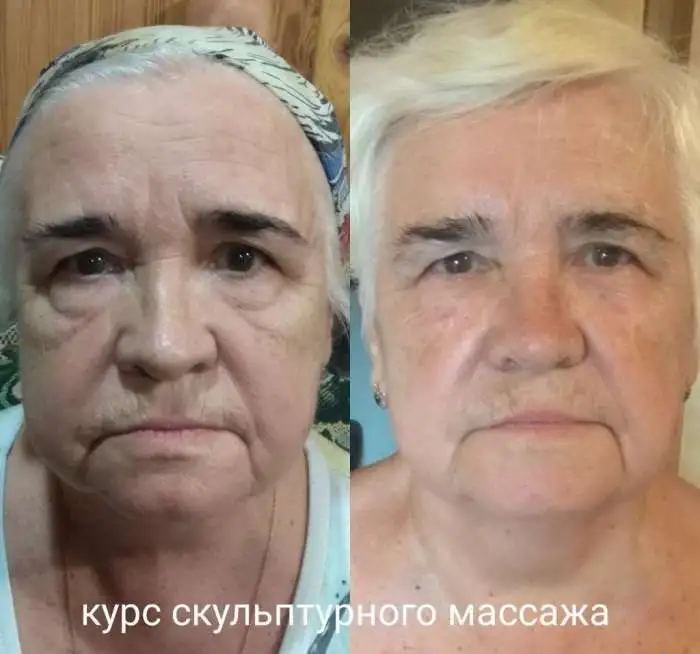 Массаж лица, фотография 6